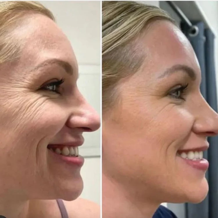 Mascarilla Nocturna Peel-Off de Colágeno 🌙